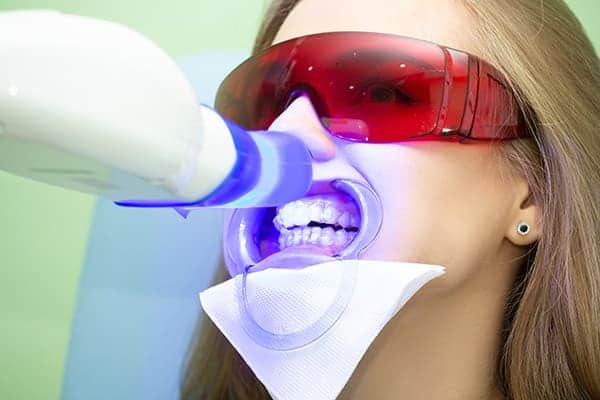 Laser teeth whitening treatments Birmingham