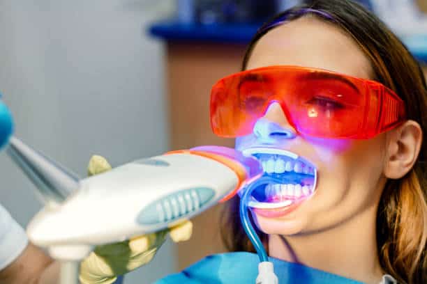 Simplifying Teeth Whitening: A Comprehensive Guide Birmingham