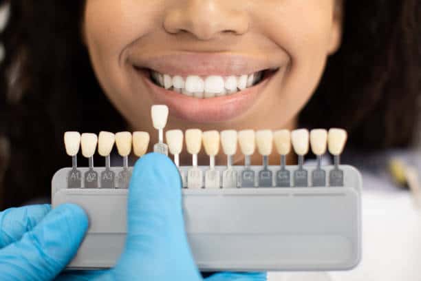 Laser Teeth Whitening: Exploring the Longevity of Your Brighter Smile Birmingham