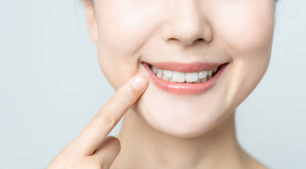 Comparing the Pain Factor: Laser Teeth Whitening vs. Zoom Teeth Whitening Birmingham