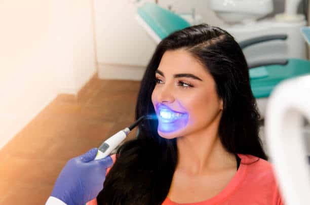 Top Teeth Whitening Systems for a Brighter Smile Birmingham