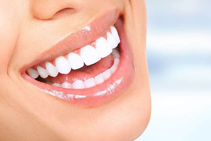 Teeth Whitening Abingdon Birmingham