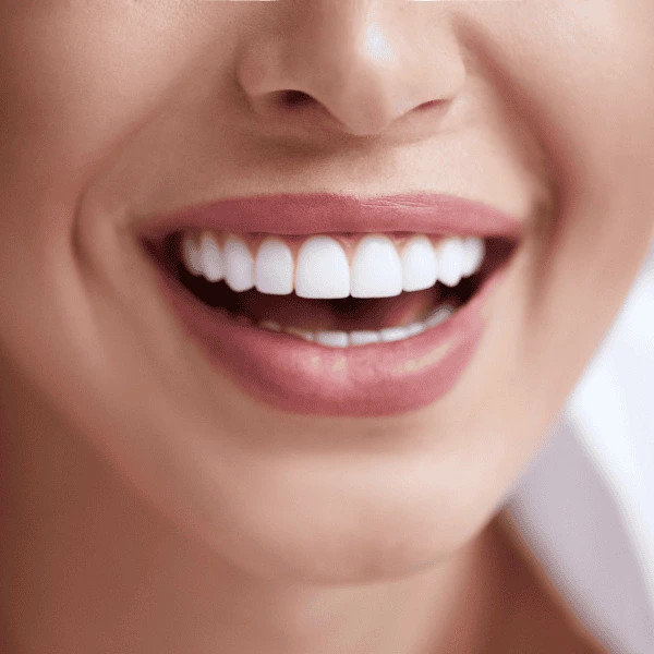 Get A whiter smile fast! Book with LA Teeth Whitening today! Birmingham